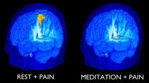 Beneficiile meditatiei - usureaza durerea