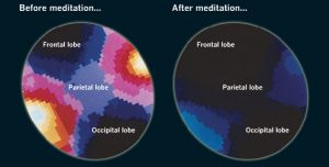 Beneficiile meditatiei - scanarea creierului